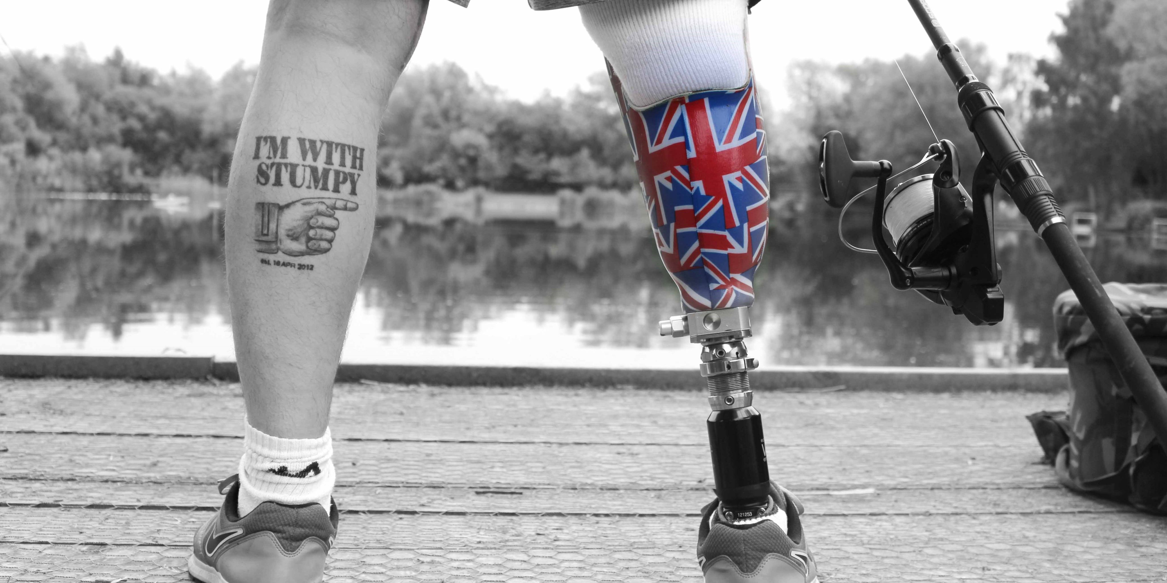 Man standing by a lake with a prosthetic leg and a fishing rod and reel.